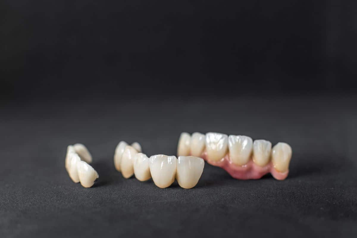 close up of dental bridges