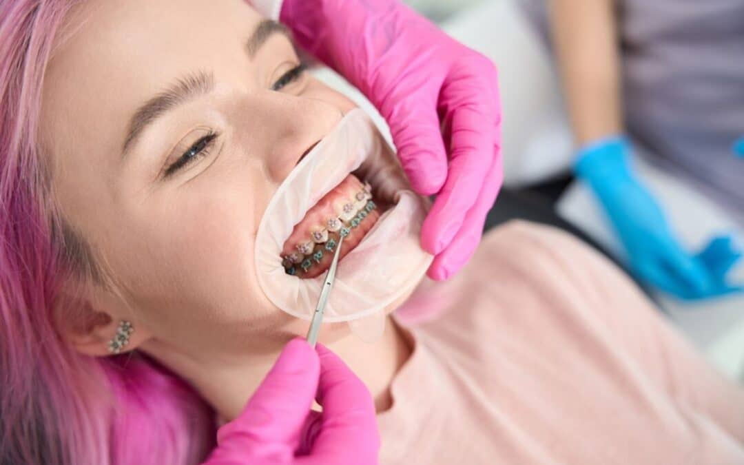 5 Things Adults Should Know When Choosing An Orthodontist