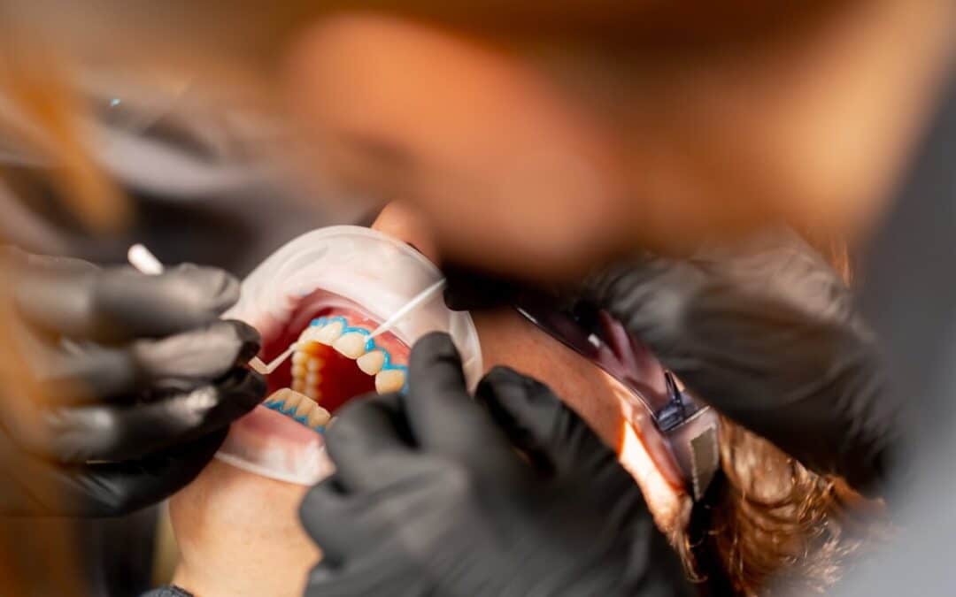 Common Reasons Teeth Stay Yellow After Dental Cleanings