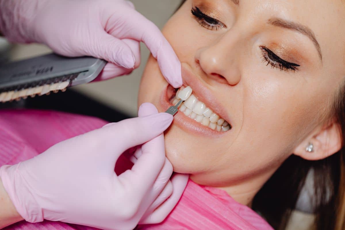 dental bonding