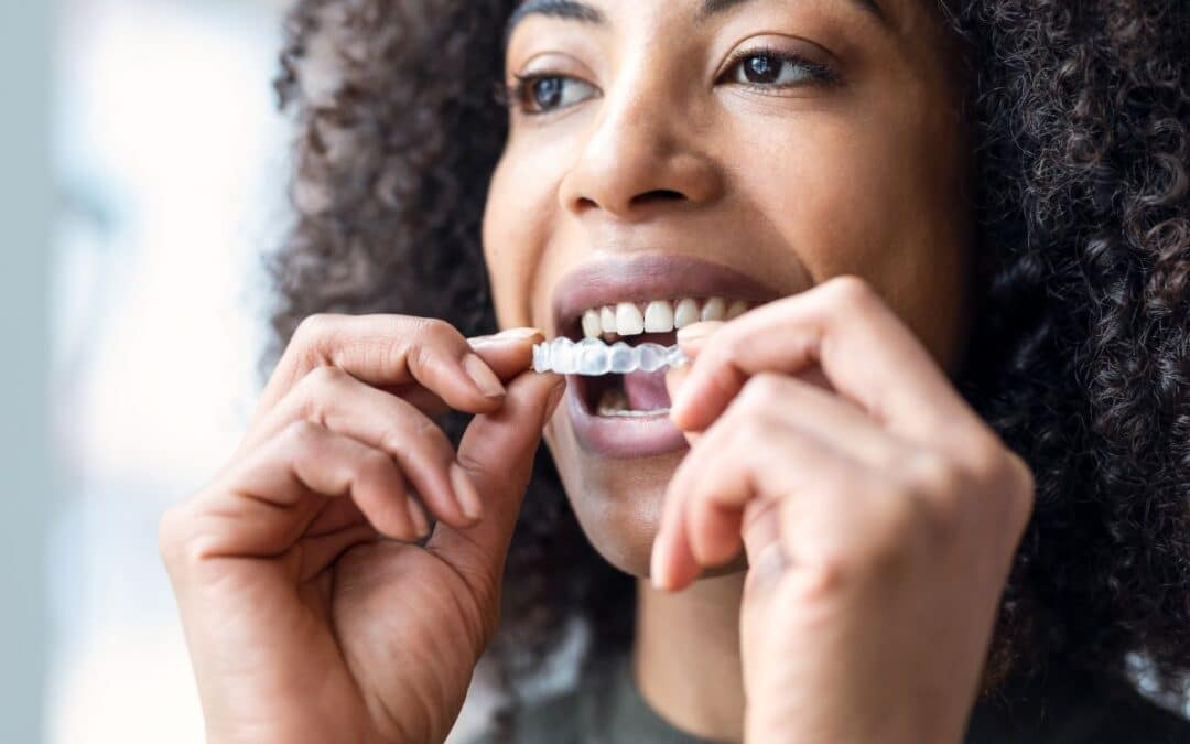 Can Invisalign Aligners Fix an Overbite?