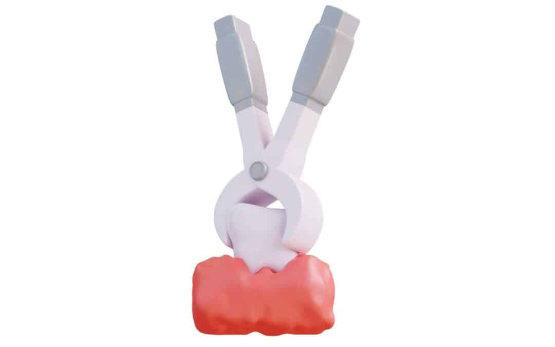 Wisdom Teeth Swelling: How to Reduce It