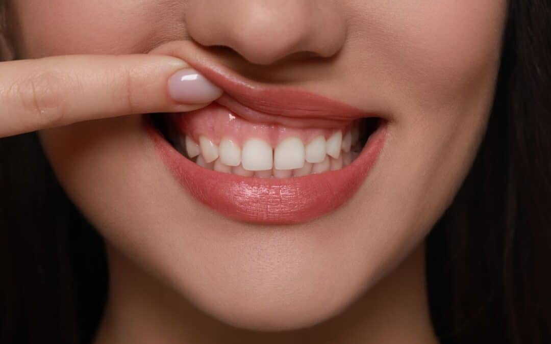 Simple Tips to Keep Your Gum Healthy