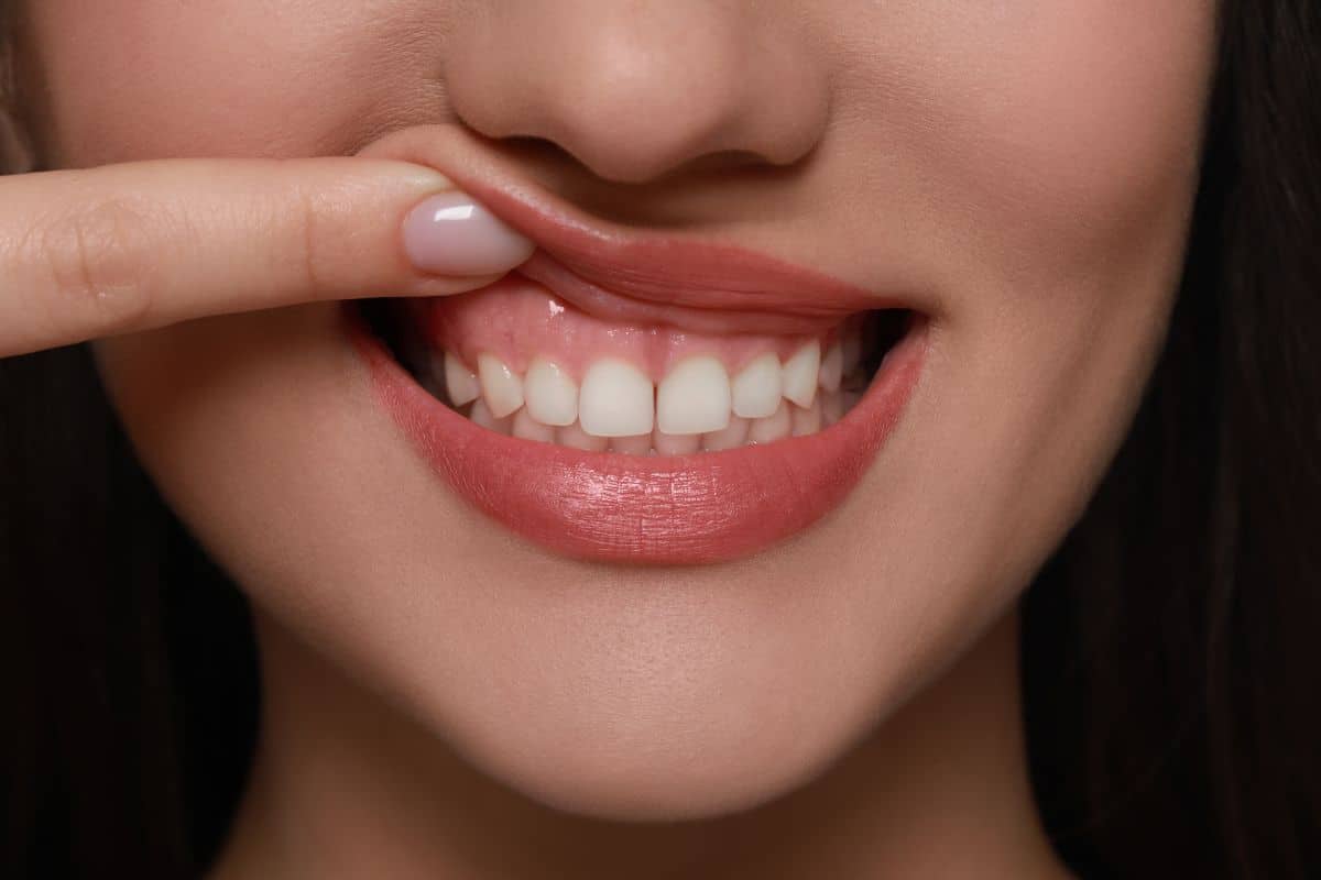 lady showing healthy gums