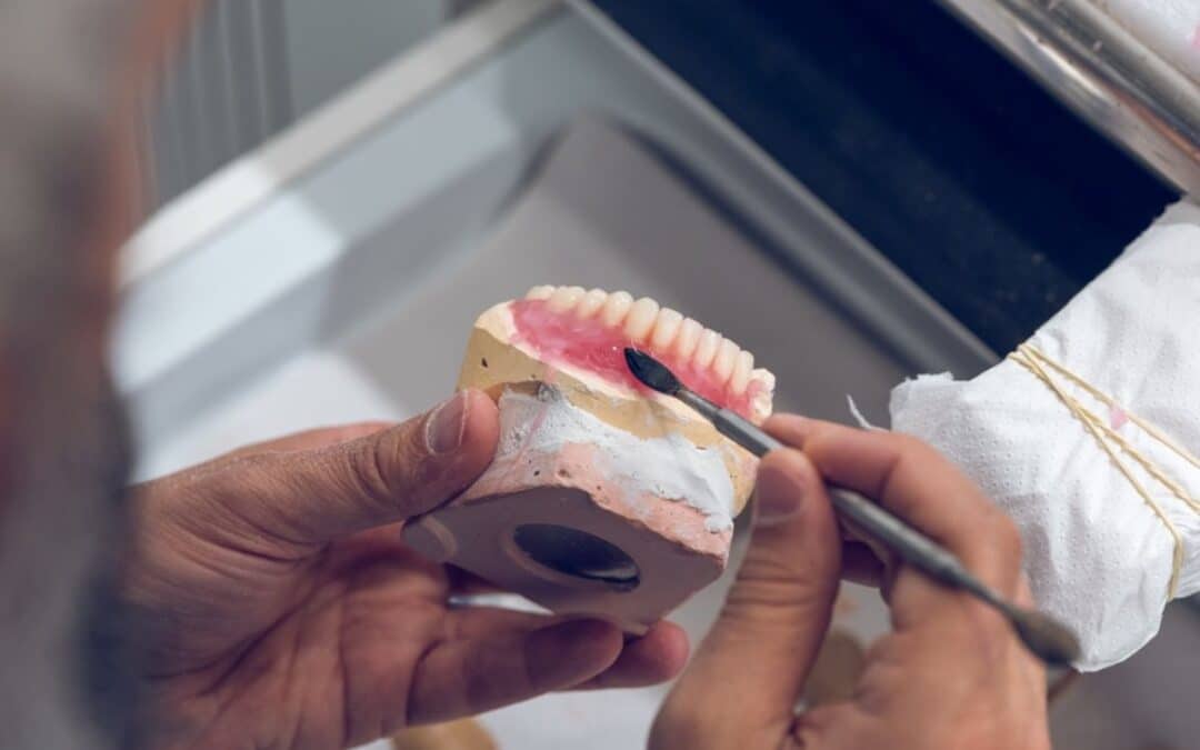 Find When Your Denture Needs A Repair
