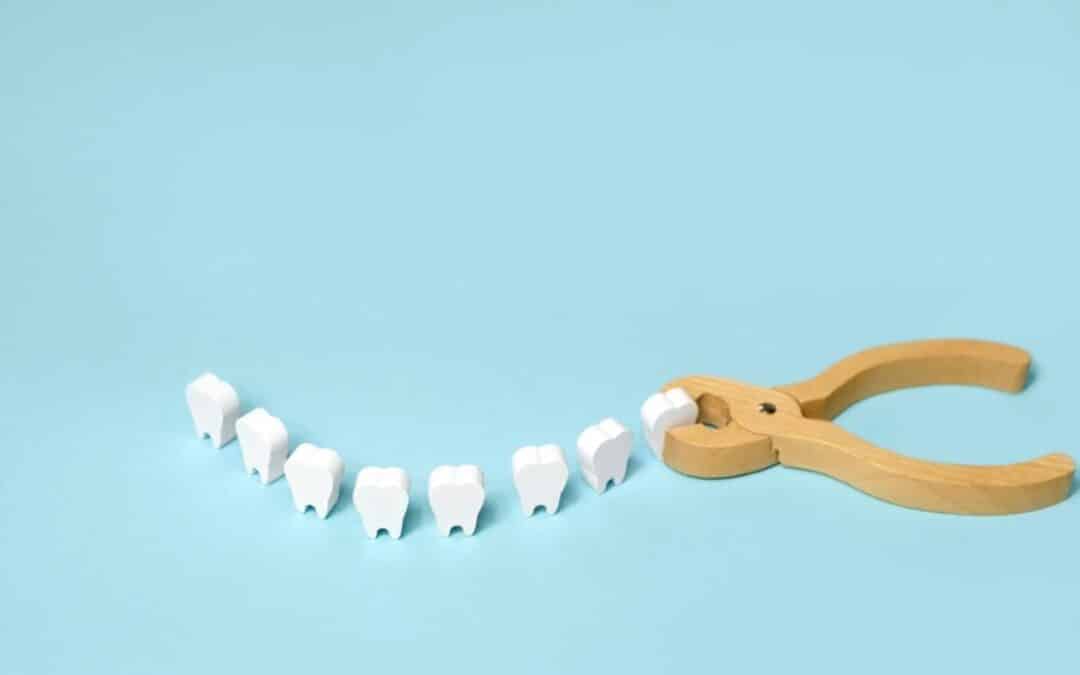 Signs You Need Your Wisdom Teeth Removed