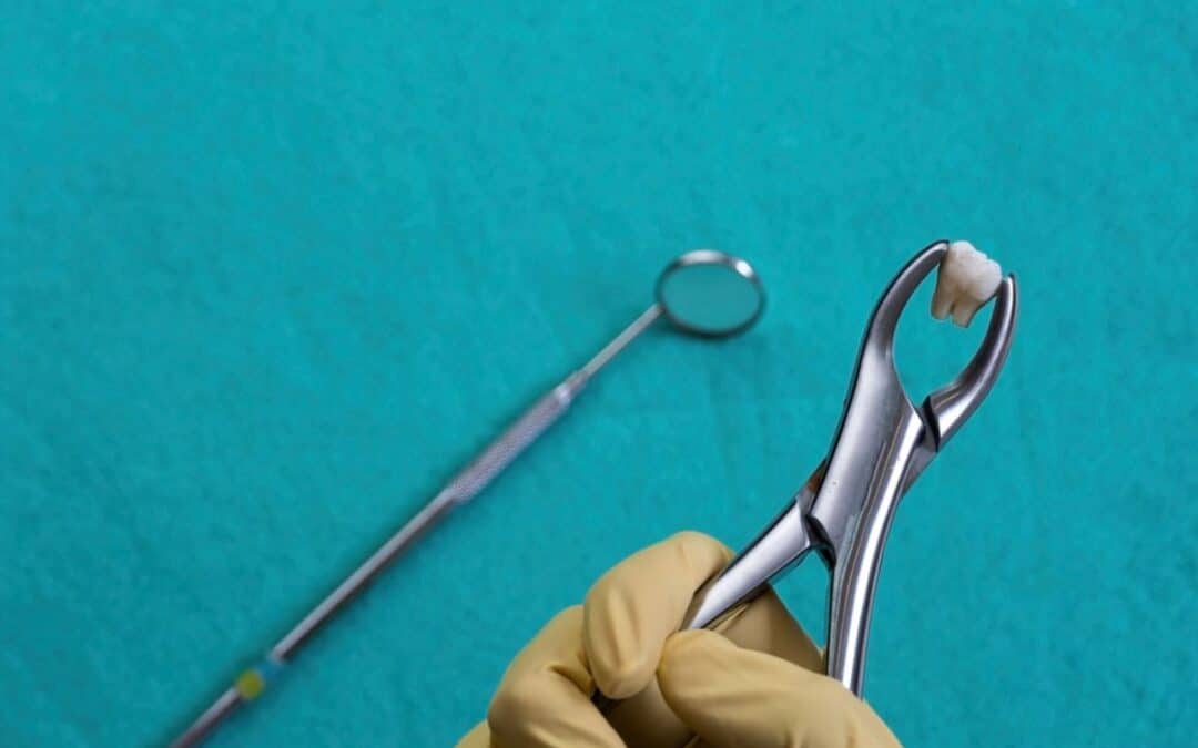 How Can I Make My Tooth Extraction Heal Faster?