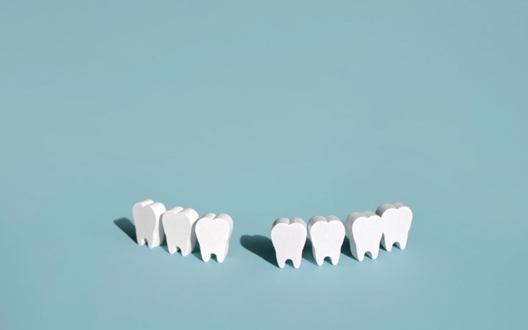 Facial Changes from Missing Teeth and The Role Of Dental Implants