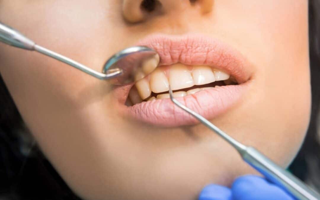 Are You Feeling Hurt During Dental Cleaning?