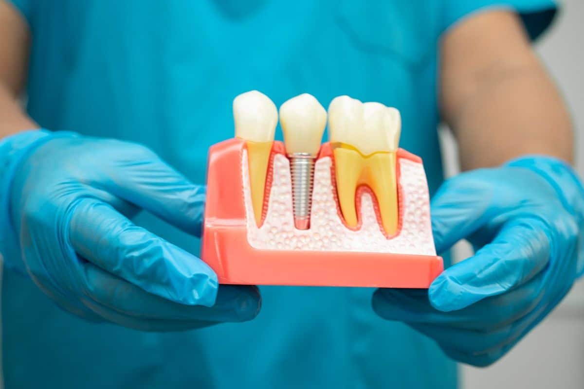 doctor explains reason for dental implants failure holding gum structure with implant