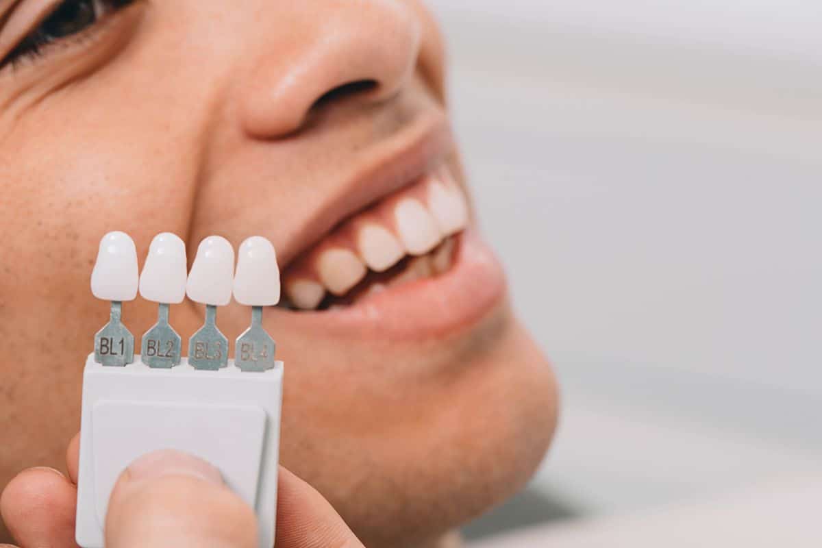 matching veneers with tooth color