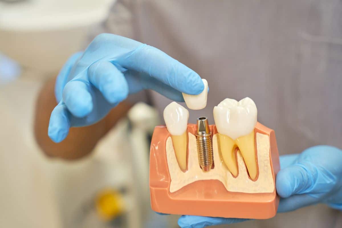 Dental Implants in Dublin