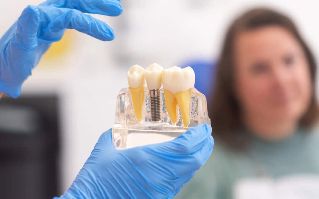 How To Fix Smelly Bad Breath After A Dental Implant?