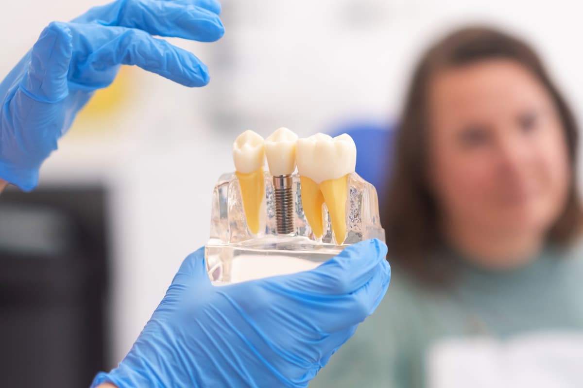 Dental Implant in Dublin