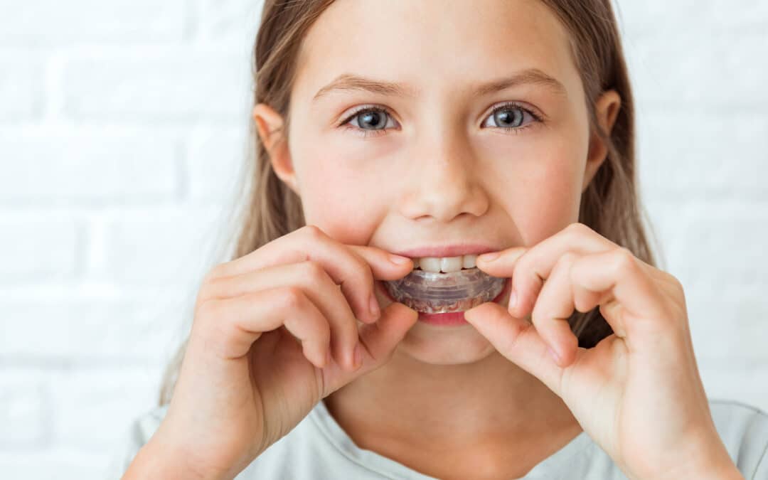 How To Protect Your Smile with Invisalign Aligners?