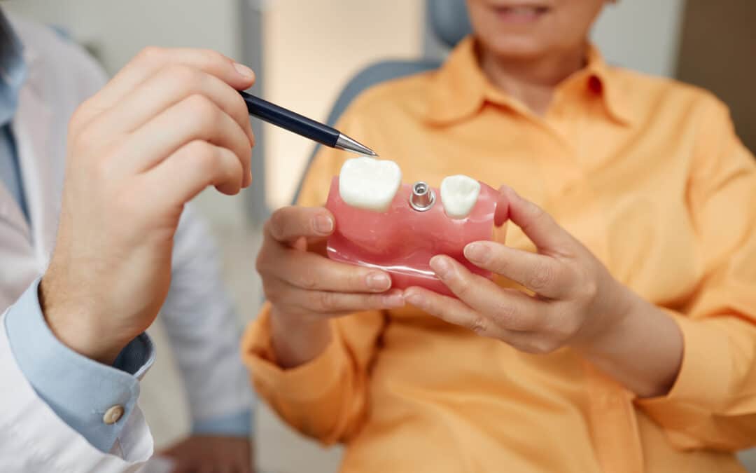 What To Eat After Dental Implant Surgery: Tips From A Dentist?